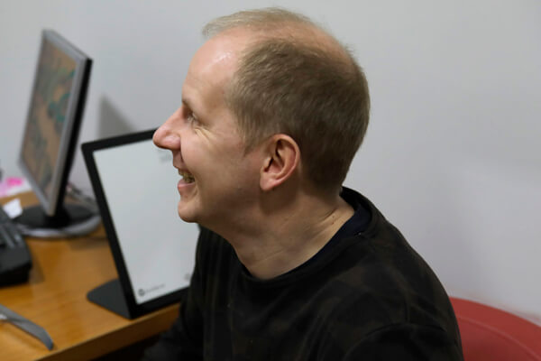 Максим Киселев: пересадка волос (фото)
